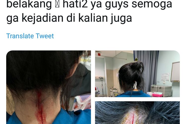 Gambar penumpang TJ yang pundaknya disayat oleh orang tidak dikenal di Halte TransJakarta Olimo, Jakarta Barat