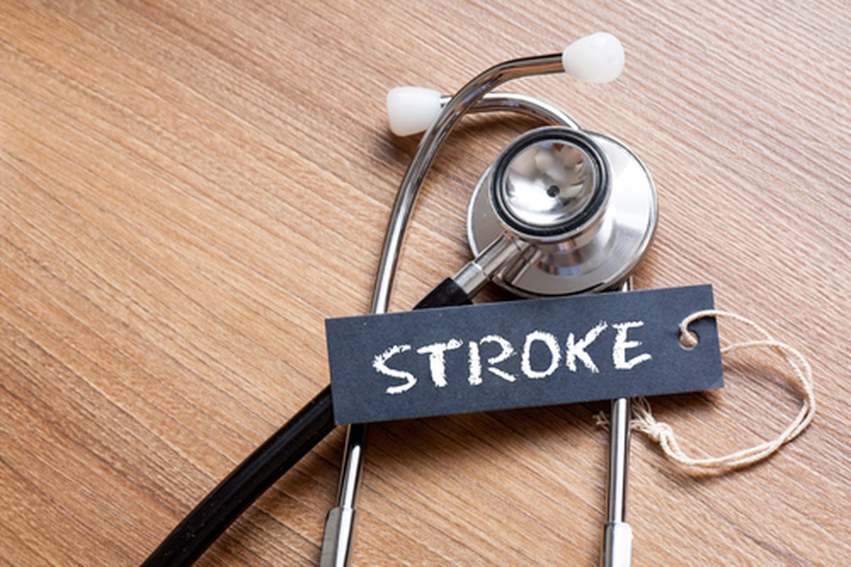 Ilustrasi stroke, jenis-jenis stroke. Jenis-jenis stroke yang paling sering menyerang adalah stroke hemoragik, stroke iskemik, dan stroke ringan.