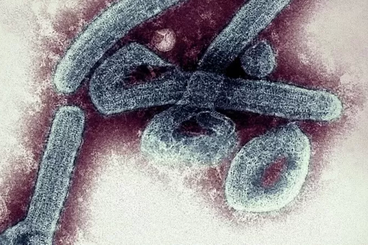 Gambar virus Marburg yang pertama kali terdeteksi di Jerman pada 1967,