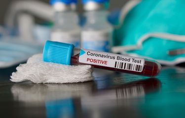 Ilustrasi virus corona