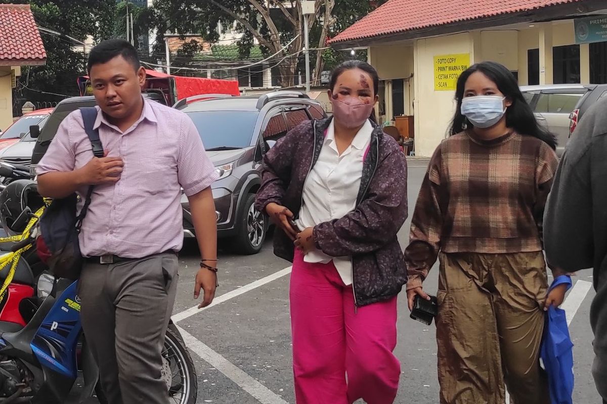 Seorang perempuan bernama Ambar (tengah) yang diduga menjadi korban tabrak kekasihnya sendiri di Jalan Pangeran Antasari, Kebayoran Baru, Jakarta Selatan, saat membuat laporan ke Polres Metro Jakarta Selatan