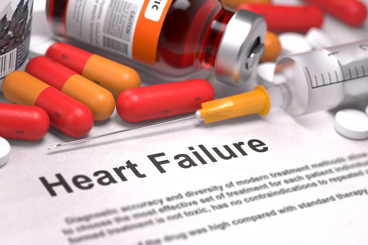 Ilustrasi cara mengobati gagal jantung, apakah gagal jantung bisa sembuh