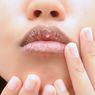 Mengenali Gejala, Penyebab, dan Cara Mengatasi Bibir Kering