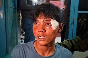 Warga Pejompongan Jakpus Mengaku Diseret dari Gang Rumah dan Dipukuli Saat Kericuhan