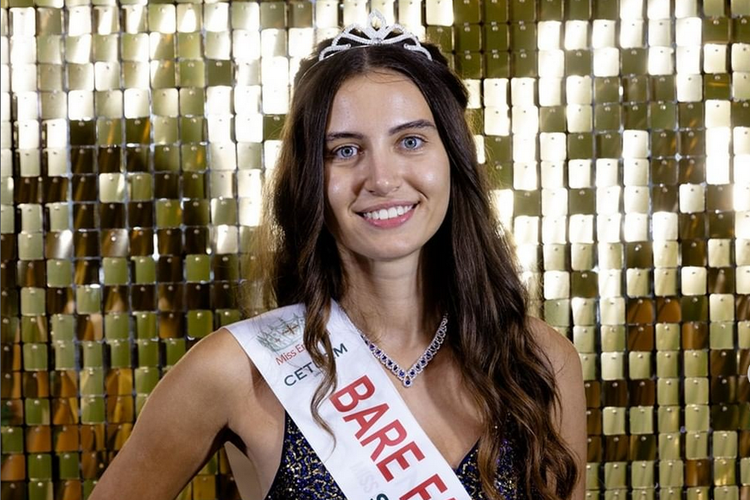 Melisa Raouf, finalis Miss England yang tampil bare face alias tanpa make up