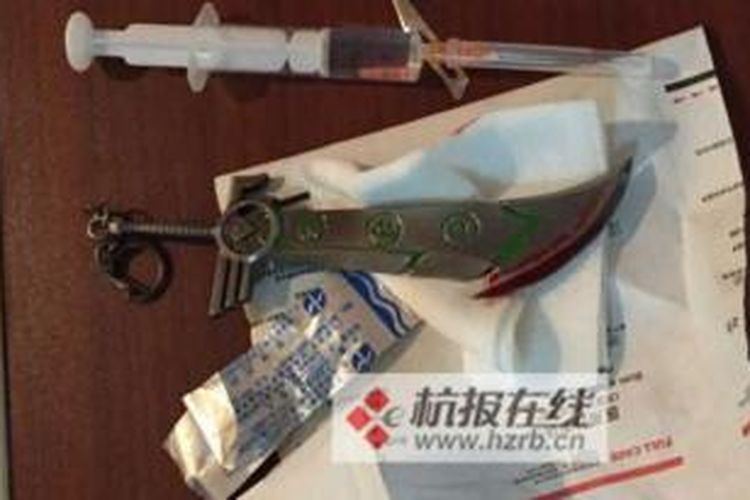 Ini pisau yang terjebak di anus Yan, pria asa Zhejiang, China.
