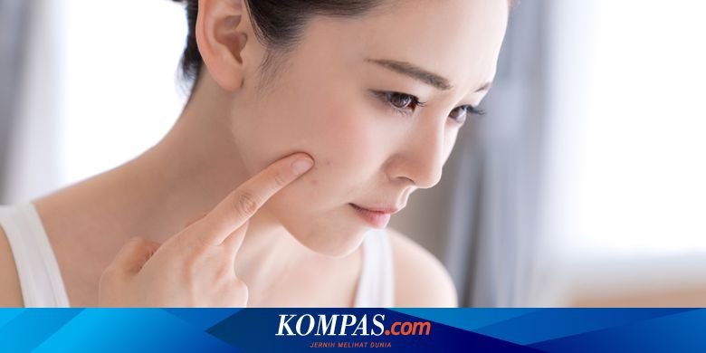 10 Fakta Seputar Jerawat Dari Mitos Hingga Pemicunya Halaman All Kompas Com