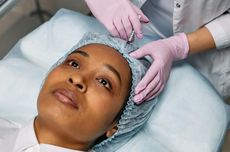 Terlalu Sering Botox Bisa Bikin Kulit Kendur, Mitos atau Fakta?