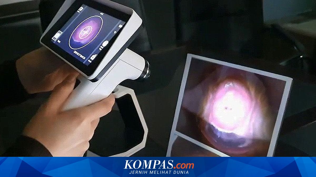 Alat Deteksi Dini Kanker Serviks Non Invansif Segera Diluncurkan