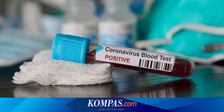 Perusahaan Jerman Mulai Uji Coba Vaksin Virus Corona pada Manusia - Kompas.com - KOMPAS.com