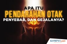 INFOGRAFIK: Mengenal Apa Itu Pendarahan Otak, Penyebab, dan Gejalanya