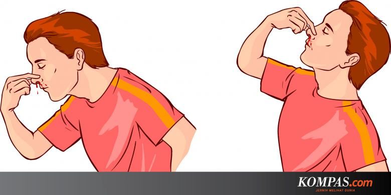 Jangan Mendongak Begini Cara Hentikan Mimisan