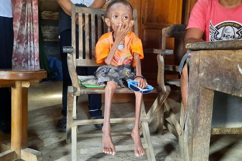 Idap Penyakit Komplikasi, Bocah 9 Tahun di Blora Tak Bisa Jalan, Begini Kondisinya