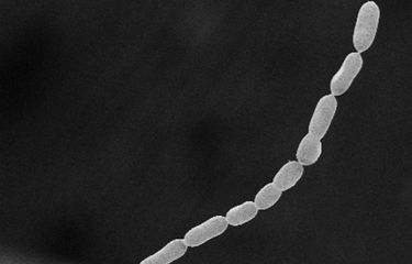 Gambar bakteri terbesar di dunia bernama Thiomargarita magnifica dirilis oleh Lawrence Berkeley National Laboratory pada 23 Juni 2022. Bakteri terbesar di dunia berukuran 2 cm ini ditemukan di hutan bakau Guadeloupe, Perancis.