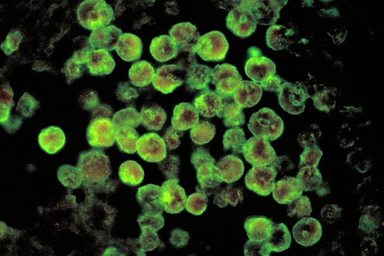 Meningoensefalitis amoeba disebabkan oleh Naegleria fowleri, yang dikenal sebagai amuba pemakan otak