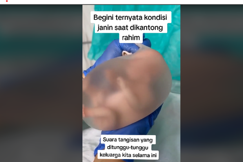 Mengenal Kelahiran En Caul, Saat Bayi Lahir Masih Terbungkus Kantung Ketuban Utuh