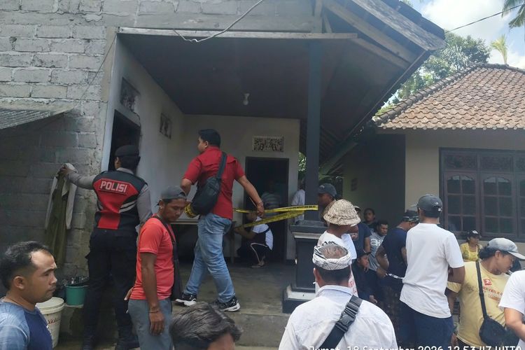 Sopir Truk Dibakar Bos di Bali Alami Luka Bakar 40 Persen, Perlu Jalani 4-5 Kali Operasi