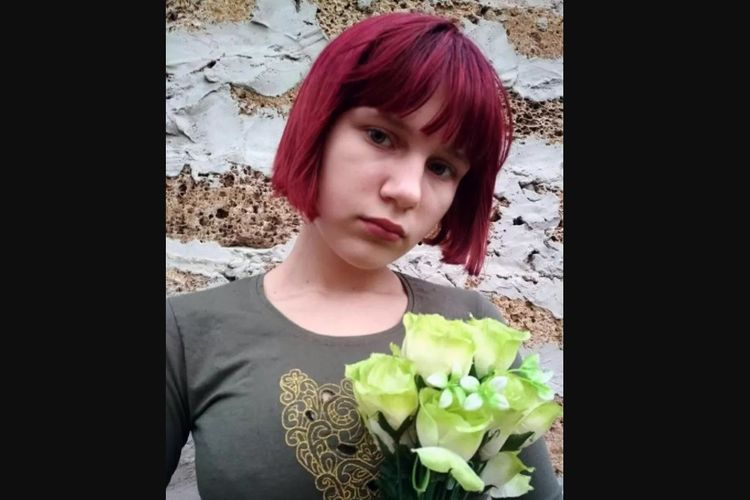 Liza Kanareikina yang masih berusia 12 tahun menjadi korban penyerangan kawanan anjing liar di Donetsk, Ukraina.