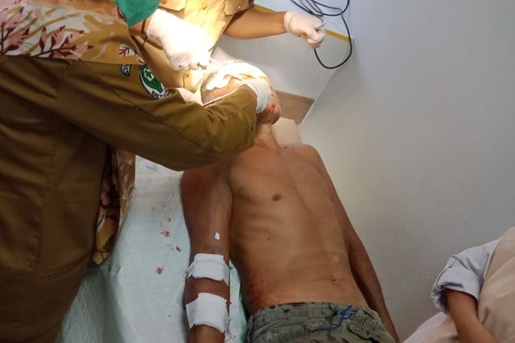 Seorang Petani Karet di Bengkulu Alami Luka Robek Diserang Beruang