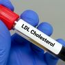 Berapa Kadar Kolesterol LDL Normal dalam Darah?