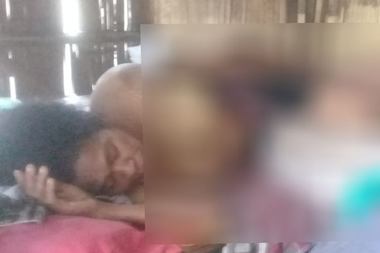 Maria Alferi (45) warga Dusun Wairotang, Desa Wairkoja, Kecamatan Kewapante, Kabupaten Sikka, Flores, Nusa Tenggara Timur penderita tumor ganas, Minggu (3/11/2019).