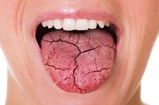 Pakar Unpad: Ada 100 Penyakit Bisa Muncul dari Mulut
