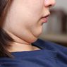 4 Cara Menghilangkan Double Chin secara Alami dan dengan Bantuan Obat