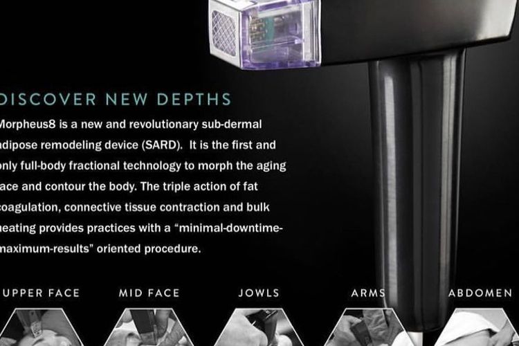 MORPHEUS 8, alat pengencangan kulit yang bantu cegah penuaan dini dalam hitungan hari