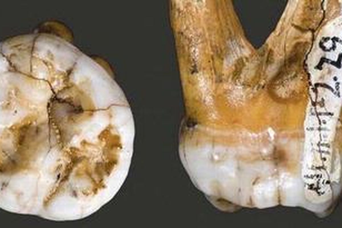 Fosil gigi manusia purba yang ditemukan di Siberia.
