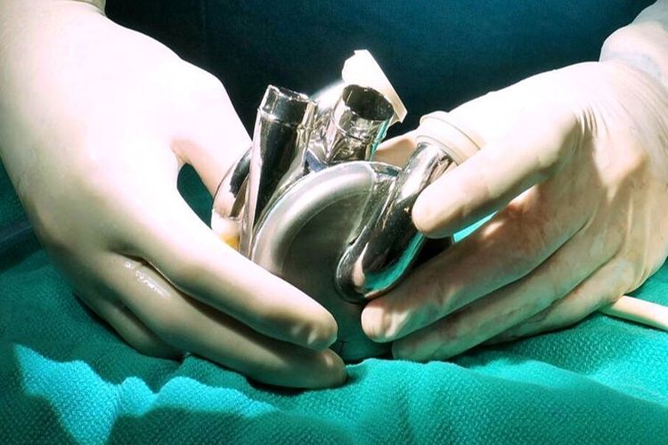 Jantung Buatan Bisa Gantikan Jantung Asli? Ini Kata Dokter Spesialis