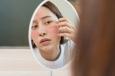 Sederet Efek Samping Retinol pada Kulit, Picu Jerawat