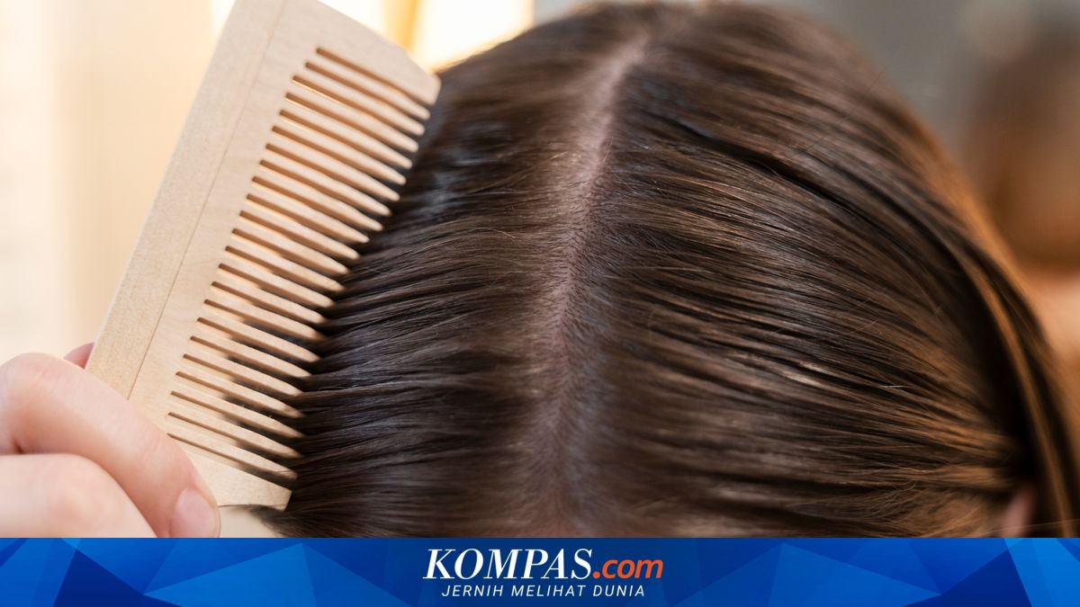 Mengapa Kulit Kepala Cepat Berminyak dan Bikin Rambut Lepek?