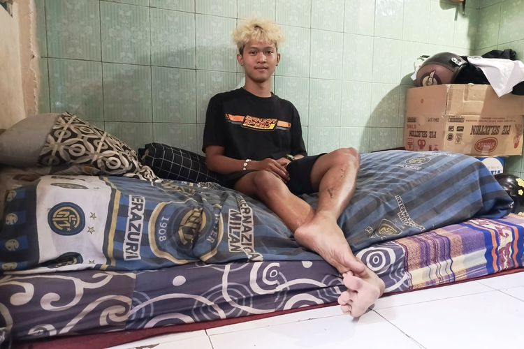 Bagas Satria salah satu korban yang sudah pulih usai patah kaki saat Tragedi Kanjuruhan yang terjadi pada pekan ke-11 Liga 1 2022-2023 seusai pertandingan bertajuk Derbi Jawa Timur, Arema FC melawan Persebaya Surabaya.