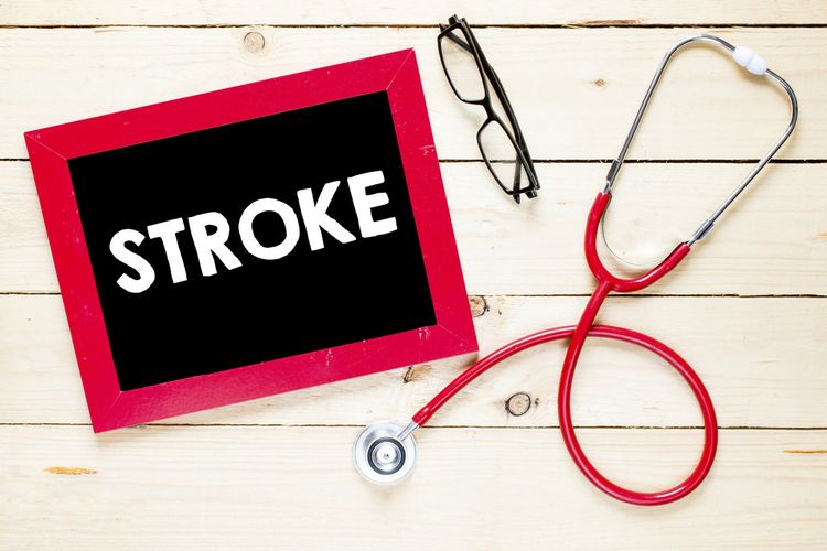 Ilustrasi stroke.