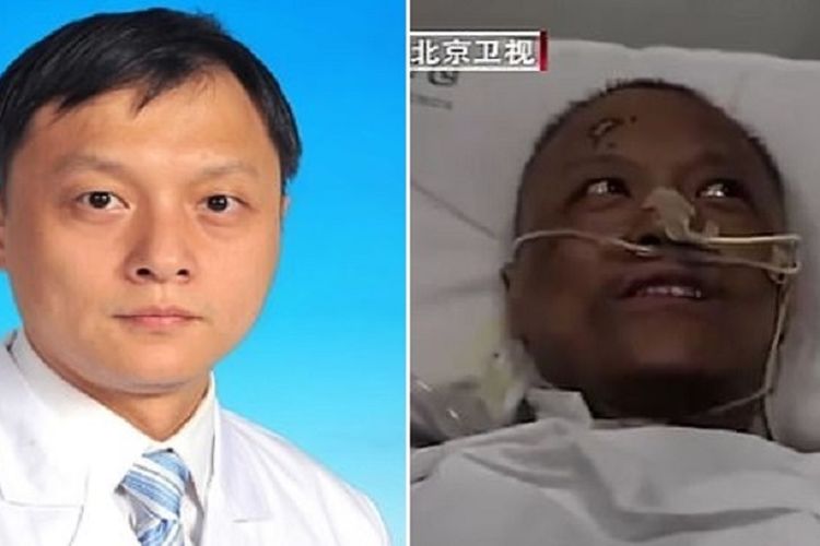 Dr Yi Fan, satu dari dua dokter di Wuhan, China yang dilaporkan kulitnya menghitam setelah nyawa mereka bisa diselamatkan dari Covid-19. Bersama koleganya Dr Hu Weifeng sama-sama terinfeksi pada 18 Januari.