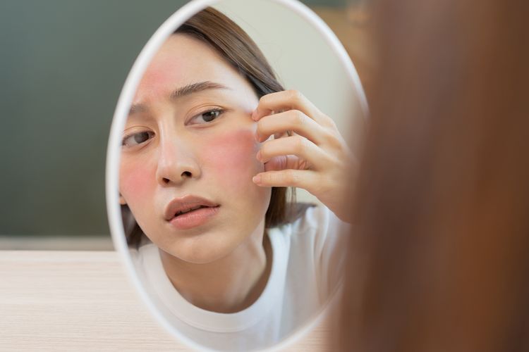 Ilustrasi kulit iritasi akibat cuka apel