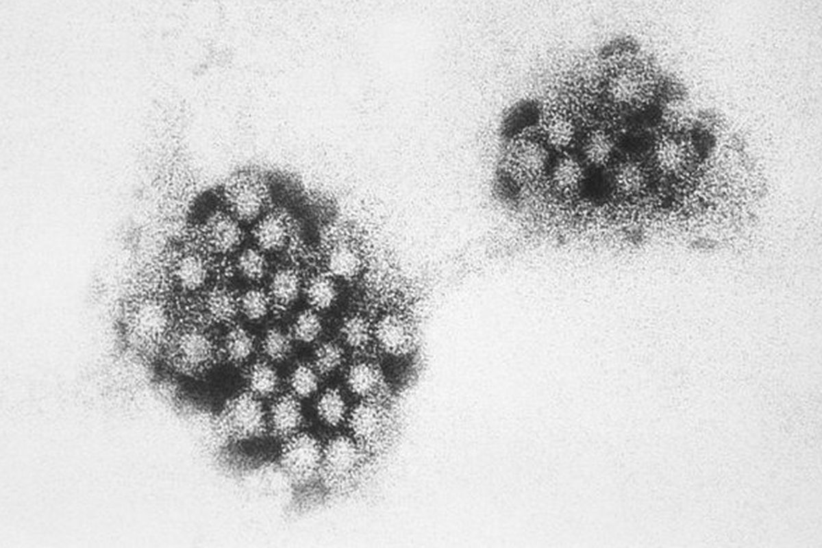 Ilustrasi norovirus berukuran 27-32 nm. Norovirus adalah sekelompok virus yang menyebabkan muntah dan diare parah. Infeksi norovirus sangat umum dan sangat menular dari orang ke orang. 