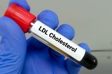 Tanda-tanda Kolesterol Sangat Rendah yang Berpotensi Berbahaya