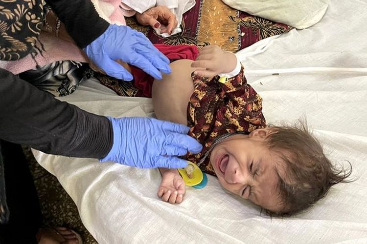 Seorang anak mendapatkan perawatan medis di Kandahar, Afghanistan pada Oktober 2021.