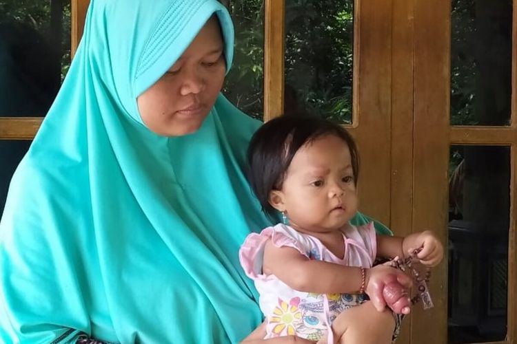 Etik Susilowati dan anaknya Samara Kumaira Mariba yang jari tangan kanannya mengalami bengkak setelah digigit kutu kucing di Sragen, Jawa Tengah.