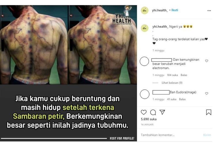 Tangkapan layar unggahan hoaks punggung seseorang yang diklaim mengalami lebam usai tersambar petir.