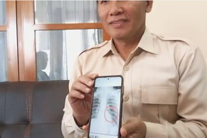 Buntut 'Tendangan Kungfu' Hilmi, PSSI Tulungagung Dukung Bawa ke Ranah Hukum