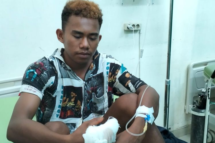 Muhaimin Ardiansyah Nampira (18), warga Kampung Waerebo, Dusun Kerora, Desa Pasir Panjang, Pulau Rinca, yang digigit Komodo pada Selasa (24/10/2023).