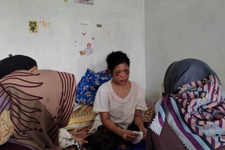 Kondisi terkini Rohimah, ART asal Garut yang disiksa majikannya di Kabupaten Bandung Barat. 