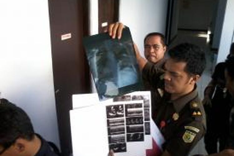 Tim jaksa Kejari Makassar memperlihatkan foto rontgen jantung tersangka korupsi dana Bansos Rp 8,8 miliar, Andi Muallim yang merupakan mantan Sekretaris Provinsi (Sekprov) Sulsel.