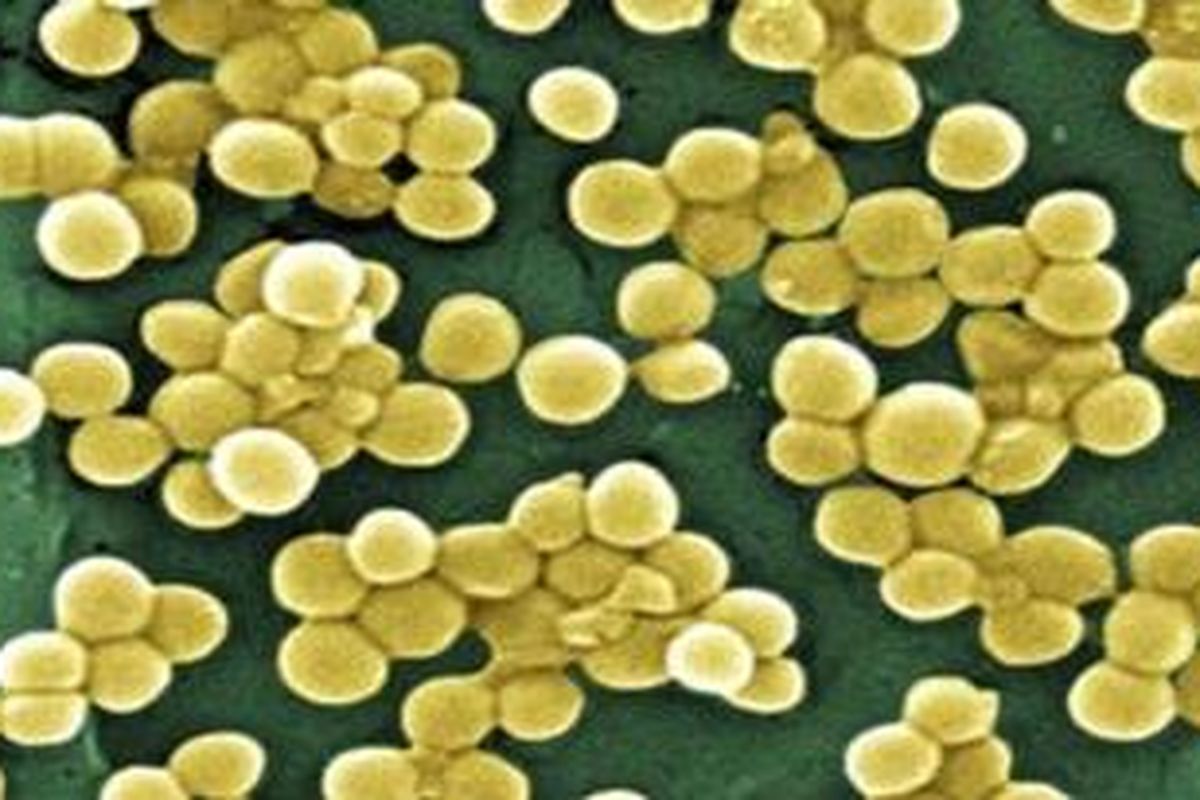 Bakteri dengan gen New Dehli-Metallo-1 (NDM-1). 