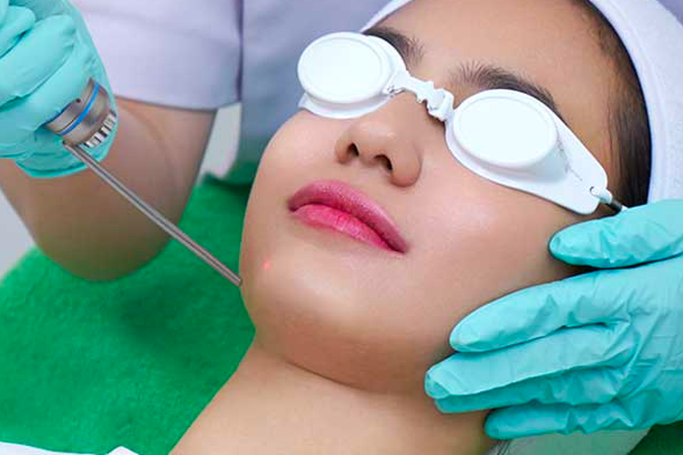 Salah satu treatment di ZAP Clinic, rekomendasi klinik kecantikan di Bogor 
