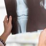 Cara Mencegah Osteoporosis Pada Usia Muda