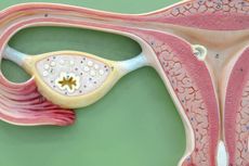 Folikel Besar Bisa Mengganggu Kehamilan?