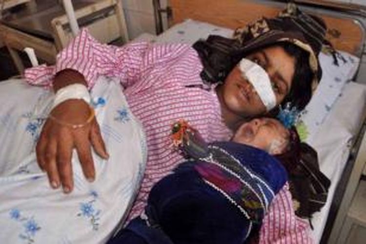 Reza Gul (20) kini harus dirawat di sebuah rumah sakit di Provinsi Faryab, Afganistan setelah hidungnya dipotong sang suami Mohammad Khan.